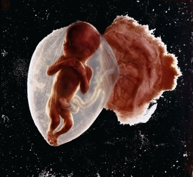 Photo-Photo Proses Pembentukan Manusia Dalam Rahim Ibu